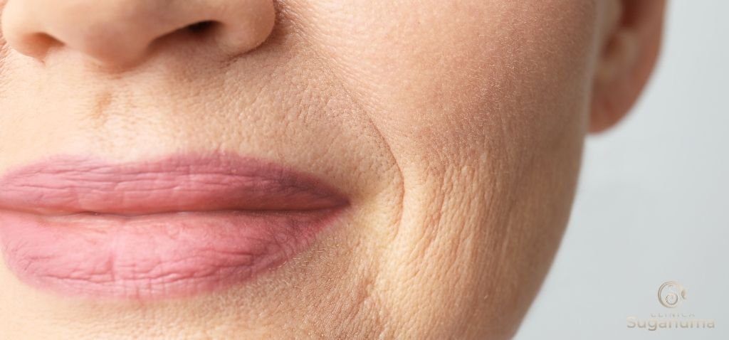 Os-tratamentos-para-o-bigode-chinês-sao-seguros-e-sem-riscos-para-a-pele