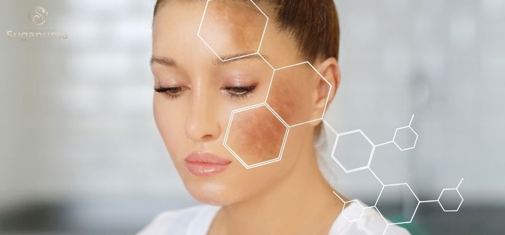 Existem-tratamentos-caseiros-para-as-manchas-do-rosto